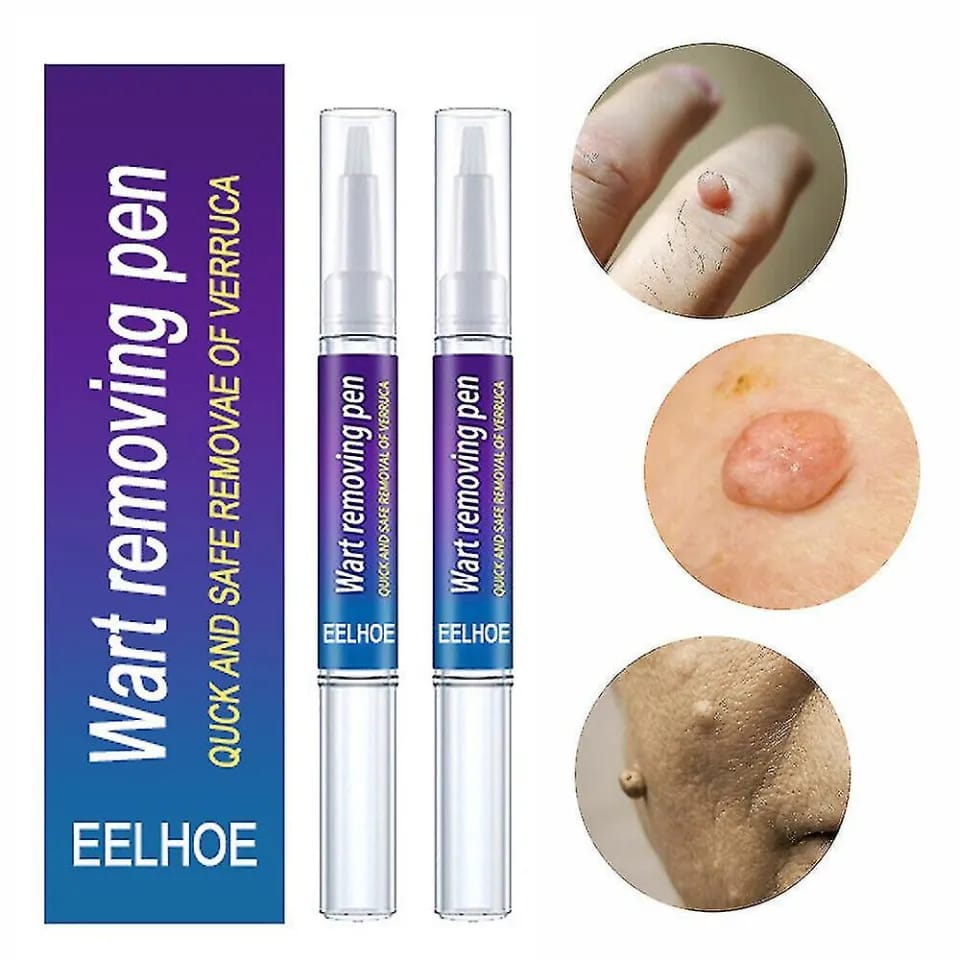 Wart Removing Pen Anti Wart Pen, Effective for Common Warts